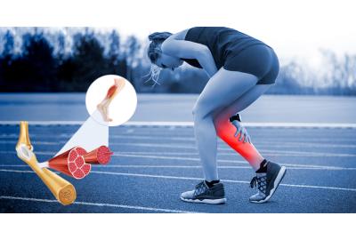 DAÑO MUSCULAR Y RENDIMIENTO FISICO: EXPLIVAR®