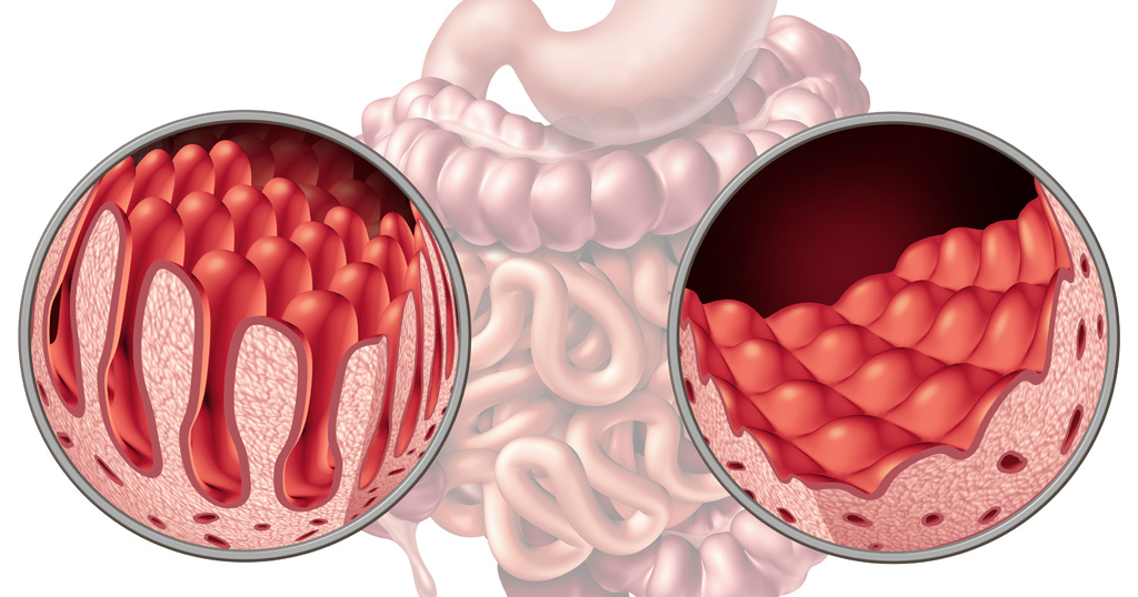 CEREALES CON GLUTEN QUE NO AFECTA A LOS CELIACOS (Entrega: 2/5)
